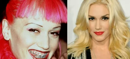 Nicki Minaj, JLO, Miley Cyrus : A quoi ressemblait les stars avant...