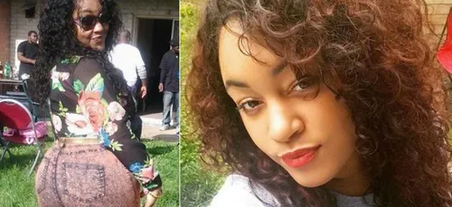 Drame : L'histoire de cette jeune femme qui meurt des suites d'une...