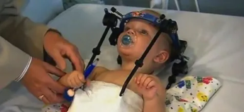 Un bébé a survécu à une décapitation interne