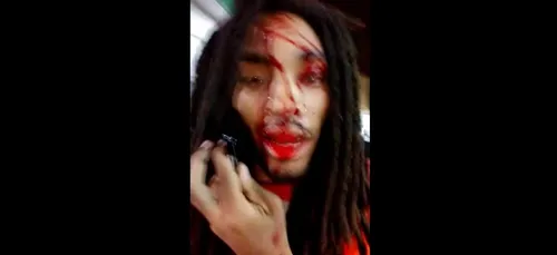 Il vient de prendre une balle en pleine tête, son  témoignage face...