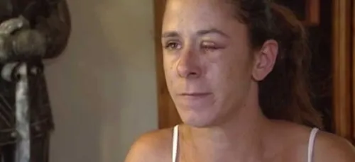 Confondre gouttes pour yeux et glue pour faux ongles peut faire...