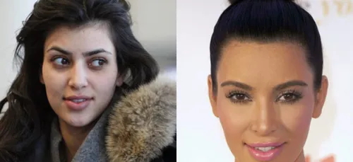 Il fut un temps où ces grandes stars étaient plutôt moches...des...