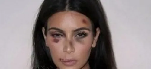 Violences conjugales: Mais qui a osé défigurer Kim Kardashian ?...