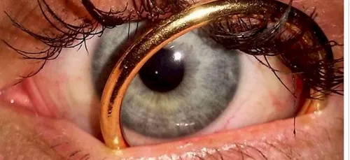 Les gens d'Instagram ont un grain... (photos)