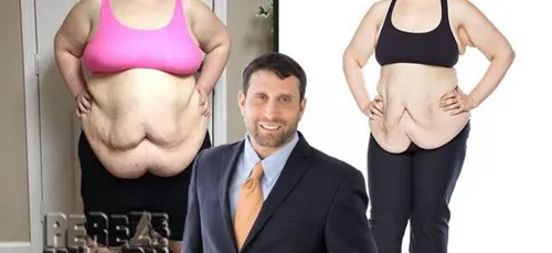 Deux candidates de la télé réalité opérées en direct sur SnapChat !!