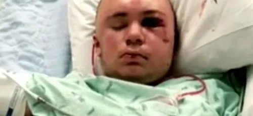 Le nouveau jeu débile sur internet, "duct tape challenge" qui a...