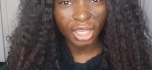 Son visage plein de cicatrices se métamorphose avec une touche de...