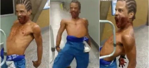 Possédé, cet homme va tenter de dévorer des patients dans un...