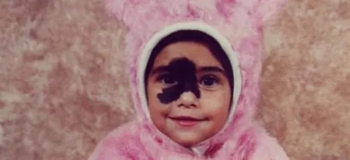 Née avec une impressionnante tache de naissance sur le visage,...