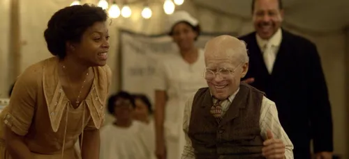 Choc ! Ce bébé né avec l'apparence d'un homme de 80 ans ! (Photo)