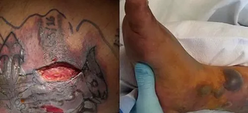 Cet homme décède après s'être baigné avec un nouveau tatouage !...