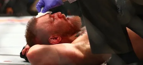 Conor McGregor mis KO à l'entrainement ?