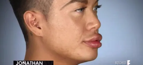 Il a des lèvres tellement énormes qu'il ne peut plus fermer la...