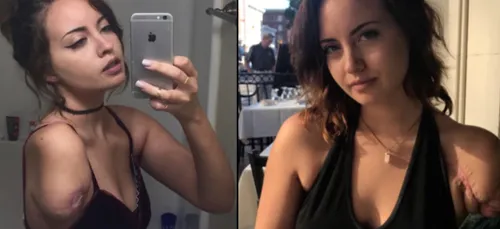 Cette jeune femme n'a qu'un seul bras mais a la meilleure...