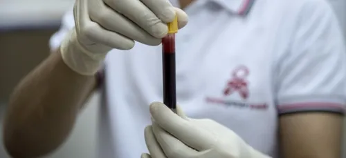 Atteint du sida, il est accusé d'avoir percé ses préservatifs et de...