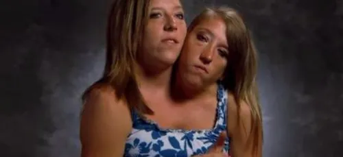 Abigail et Brittany, sœurs siamoises, ont décroché un poste de...