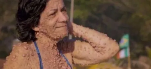 Entièrement recouverte de tumeur, elle assume son corps au point...