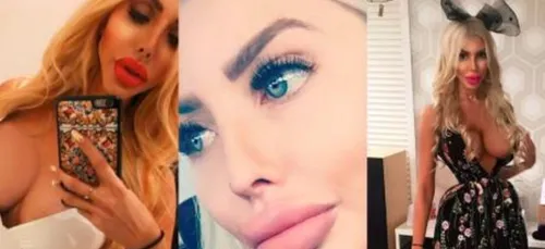 Âgée de 25 ans, Anella se considère comme la première Barbie...