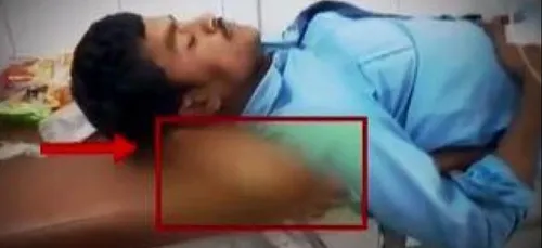 En guise d'oreiller, un patient à le droit à une jambe amputée !