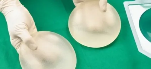 Des implants mammaires reconnus responsables d'une rare forme de...