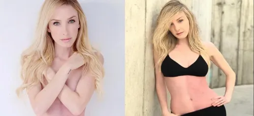 Après avoir absorbé sa sœur, ce mannequin à le ventre bicolore !