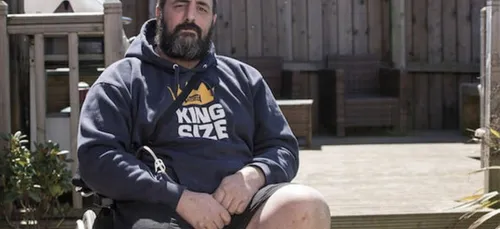 Un anglais, amputé d'une jambe à cause d'une petite araignée !