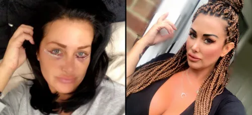 Cette maman dépense 120.000 euros pour paraître plus jeune