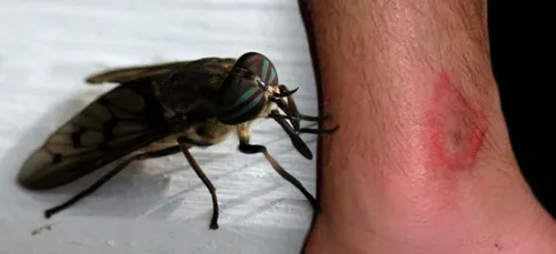 Été : évitez de vous faire piquer ou mordre par ces 10 insectes !