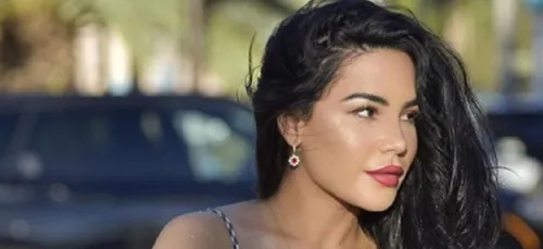 Milla Jasmine : son visage transformé choque les internautes !...