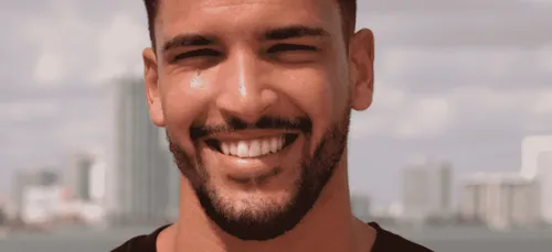 Selim des Anges : victime d’un grave accident « Ma tête est...