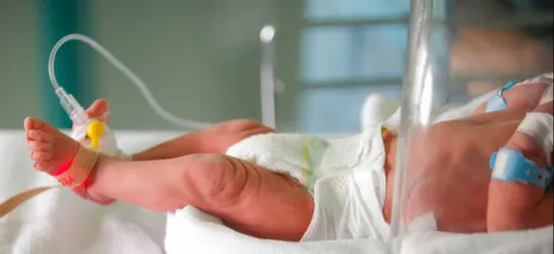 Au Portugal la naissance d'un bébé sans visage fait polémique !