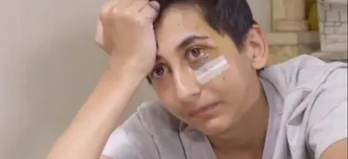 Violences policières : le témoignage d'un ado de 14 ans, défiguré...