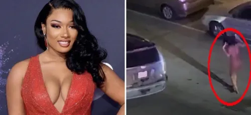 Megan Thee Stallion : la rappeuse, blessée par balles ! [PHOTO]