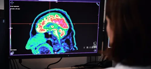 Covid-19 : les répercussions sur le cerveau seraient terribles?