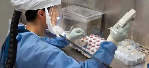 Covid-19 : le virus issu d'un laboratoire ?