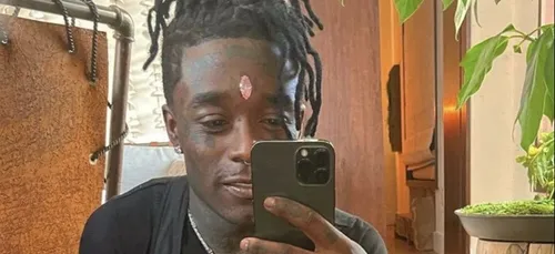 Lil Uzi Vert s'est implanté un diamant pour ne pas le perdre !