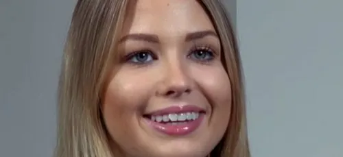 Enjoy Phoenix pose sans maquillage et dévoile son acné hormonale...