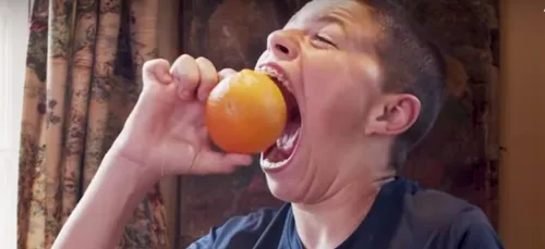 Cet enfant de 14 ans a la plus grande bouche du monde (Vidéo)
