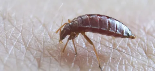 Punaises de lit : recrudescence de consultations chez le médecin...