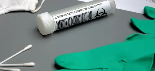 Covid-19 : un test nasal perfore la paroi du cerveau d’une Américaine