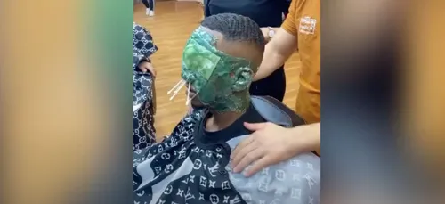 S’épiler le visage entier avec de la cire, la nouvelle tendance...