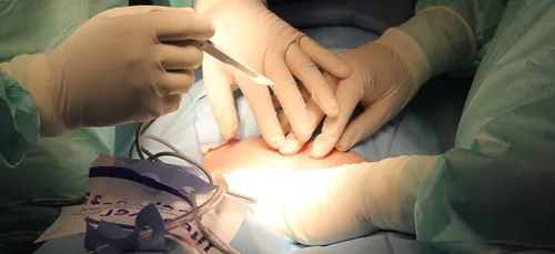 Chalon-sur-Saône : deux patients opérés sans anesthésie