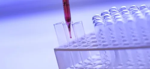 Segré : une nouvelle antenne de dépistage des IST s’installe au...