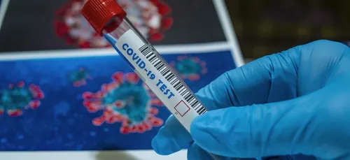 Loiret : 20 cas supplémentaires de Covid 19 dans un abattoir de...