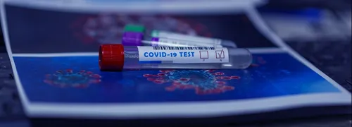 Loiret : un petit foyer de Covid-19 détecté chez Veolia à Chaingy