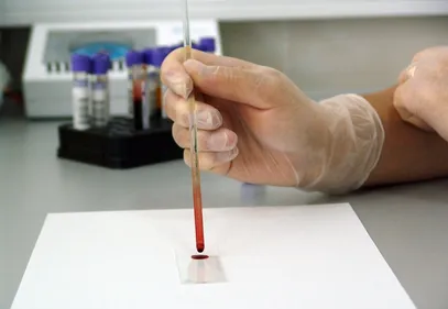 Des chercheurs ligériens au cœur d’un plan de lutte européen contre...