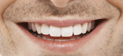 Il perd toutes ses dents lors d'une opération