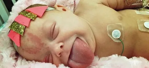 Le bébé naît avec une langue d'adulte!