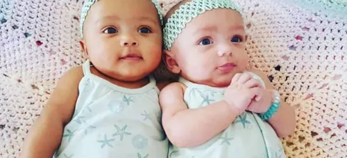 Les jumelles de couleur différente