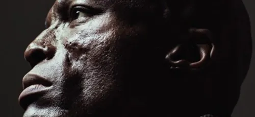 Seal révèle l'origine des cicatrices sur son visage (VIDEO)